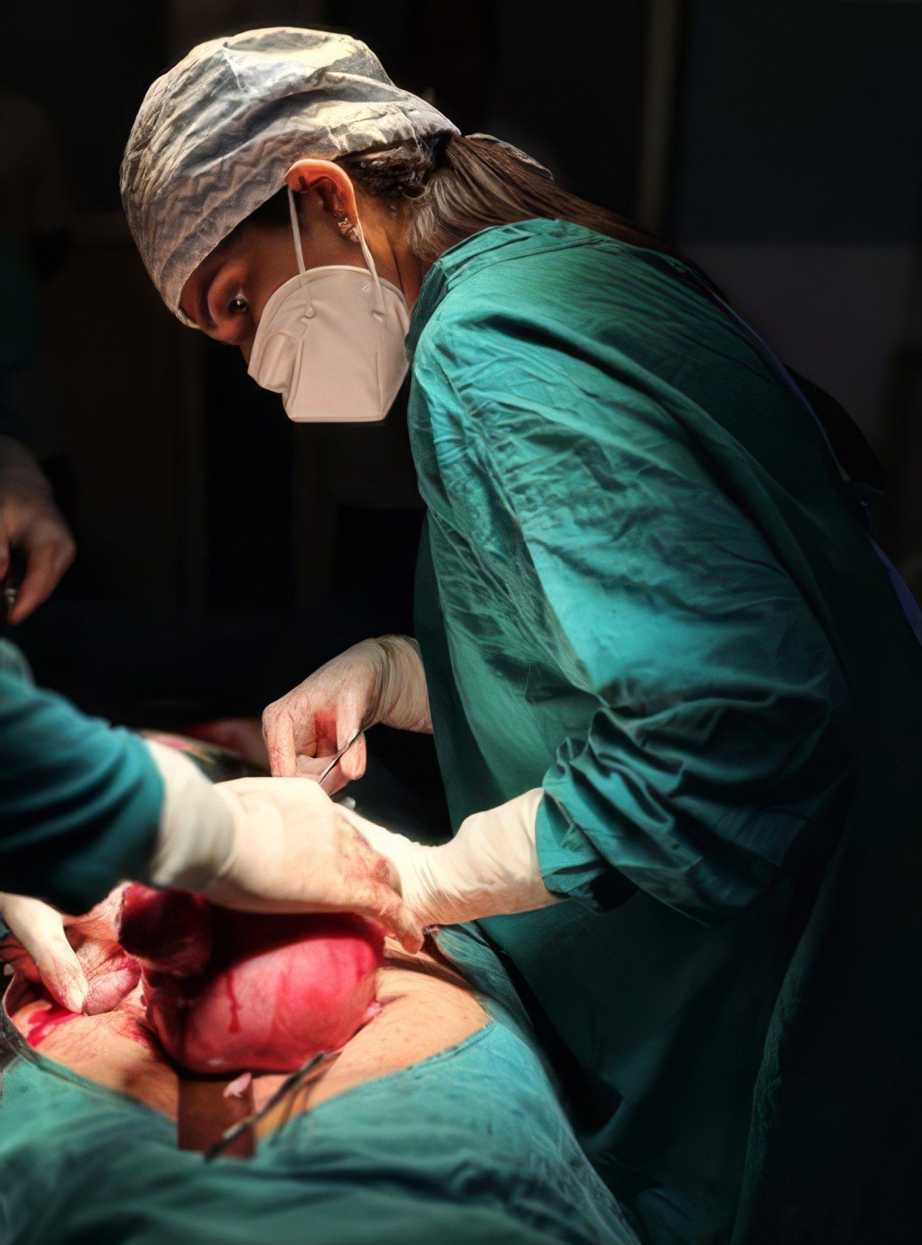 Dr. Khyati S. Daru lifts a large mass during an operation