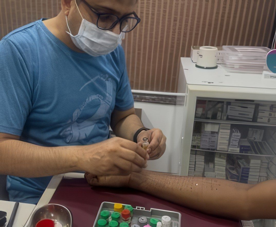 Preparing a skin prick test
